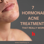 Hormonal acne treatment tips for an adult lady having jaw acne
