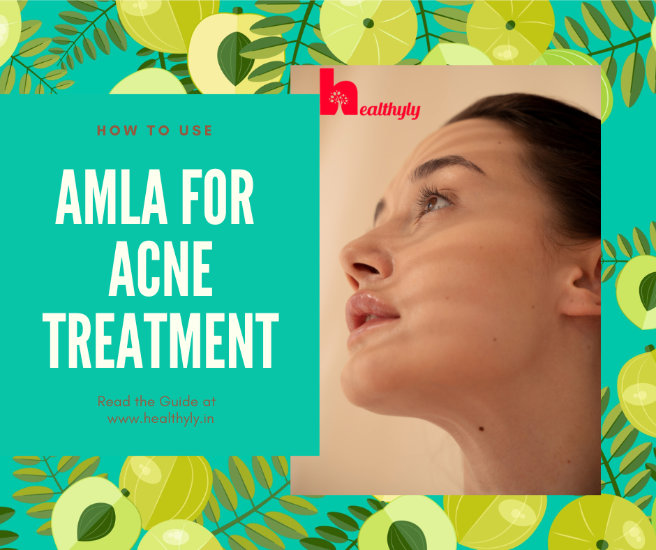How to Use Amla For acne Treatment at home
